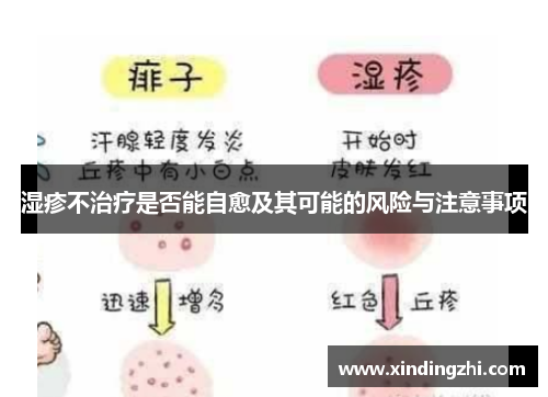 湿疹不治疗是否能自愈及其可能的风险与注意事项